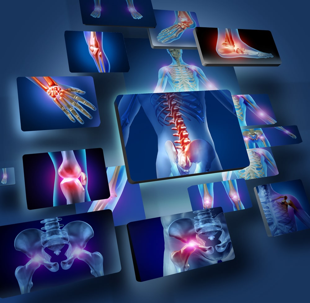 joint pain X-rays
